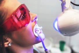 Mách bạn cách tẩy trắng răng được nhiều nghệ sĩ Việt yêu thích