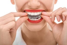 Vì sao niềng răng không mắc cài giá đắt hơn các loại niềng răng khác?