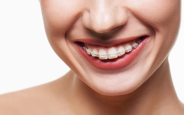 Nha Khoa Sài Gòn bác sĩ Quang tư vấn niềng răng