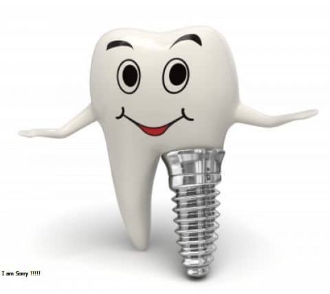 Trồng răng implant ở đâu tốt, vừa tiết kiệm lại vừa an toàn?