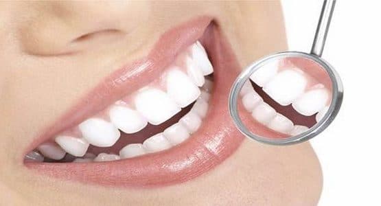 Trồng răng cố định và 4 vấn đề cần nắm rõ trong tầm tay