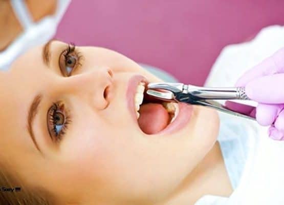 trồng răng bằng phương pháp implant