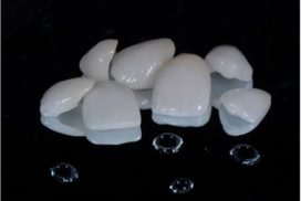 mặt dán răng sứ