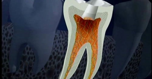 Biện Pháp Phòng Ngừa Viêm Tủy Tiêu Xương Tái Phát
