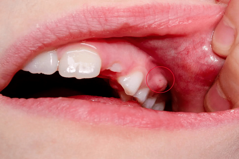 Các Phương Pháp Điều Trị Suy Giảm Mô Hiệu Quả