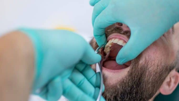 Dị Sản Xương Ổ Răng: Giải Pháp Hiệu Quả và An Toàn