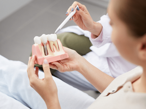 Hướng Dẫn Từng Bước Chăm Sóc Mô Mềm Sau Cấy Ghép Implant