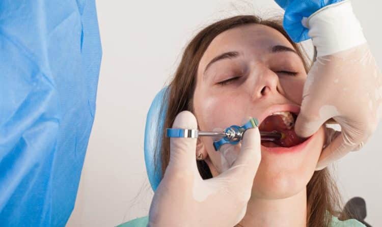 Những Lưu Ý Quan Trọng Khi Nhổ Răng Khôn Để Tránh Biến Chứng