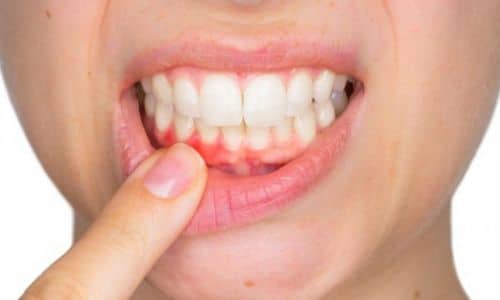 Phục Hồi Mô Sau Viêm Nhiễm: Giải Pháp và Lợi Ích