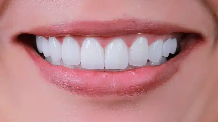 Vai Trò Của Chăm Sóc Răng Miệng Trong Phòng Ngừa Nhiễm Trùng Xương Hàm