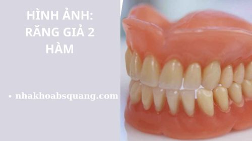 hình ảnh răng giả 2 hàm