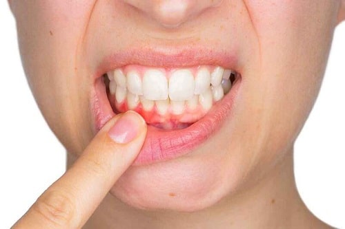 Phương Pháp Chữa Tụt Lợi Hiệu Quả: Lựa Chọn Nào Phù Hợp Với Bạn?