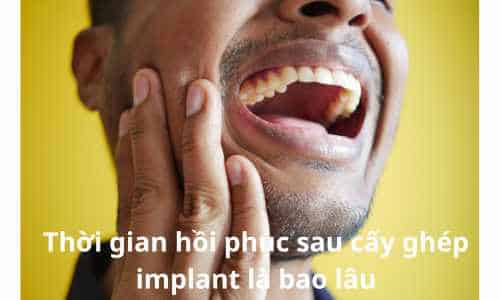 thời gian hồi phục sau cấy ghép implant bao lâu