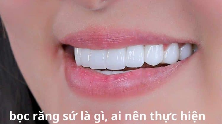 bọc răng sứ là gì, ai nên thực hiện