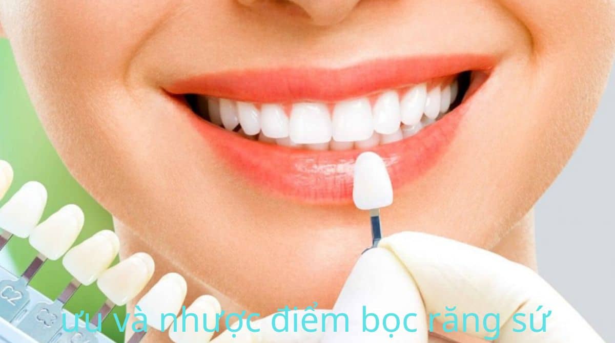 ưu nhược điểm của bọc răng sứ